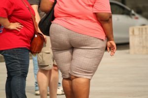 Fettleibige Frauen, zu sehen ist der Rumpf.